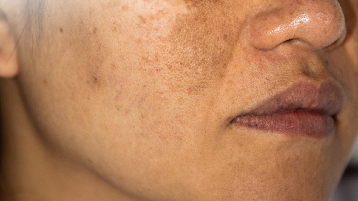 Pengaruh keseharian terhadap kondisi kulit